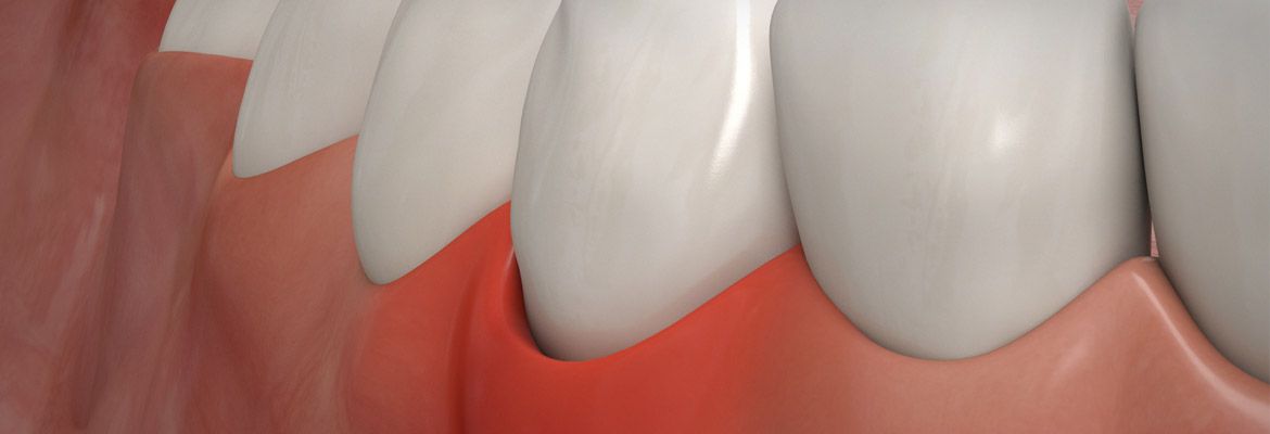 Ihre Zahnärzte in Laer – Prophylaxe, Implantate, Ästhetik & Co.